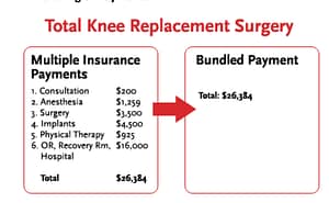knee replacement